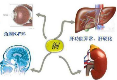 铜元素超标危害大